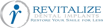 Revitalized Dental Implants
