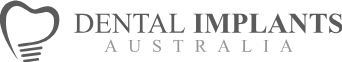 Dental Implants AU