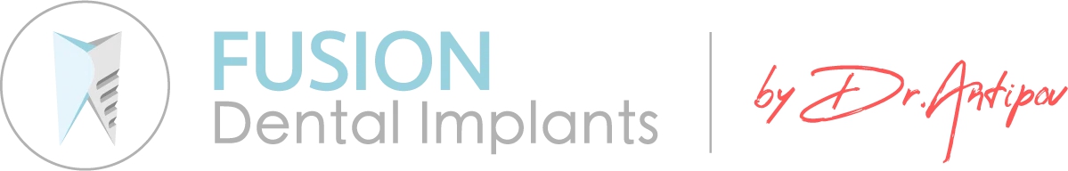 Fusion Dental Implant Club