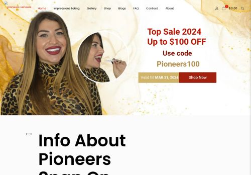 Pioneers Veneers capture - 2024-04-05 17:58:55