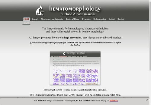 hematomorphology.info capture - 2025-05-01 23:02:02