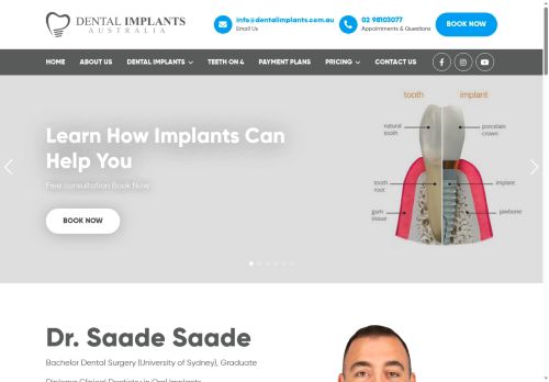 Dental Implants AU capture - 2025-07-08 00:10:34