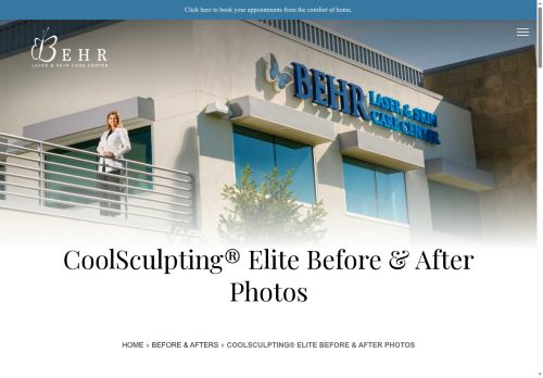 fresnocoolsculpting.com capture - 2025-08-17 12:58:00