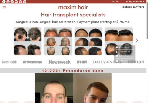 hairtransplantslasvegas.com capture - 2025-09-11 21:00:20