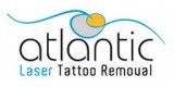 Atlantic Tattoo Removal