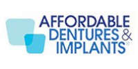 Dental Implants Port St. Lucie